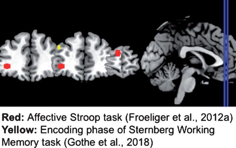 Le yoga favorise la régulation émotionnelle, réduit le stress, l'anxiété et la dépression et améliore le fonctionnement global du cerveau. L'amélioration de la régulation émotionnelle pourrait être la clé des effets positifs du yoga sur le cerveau.